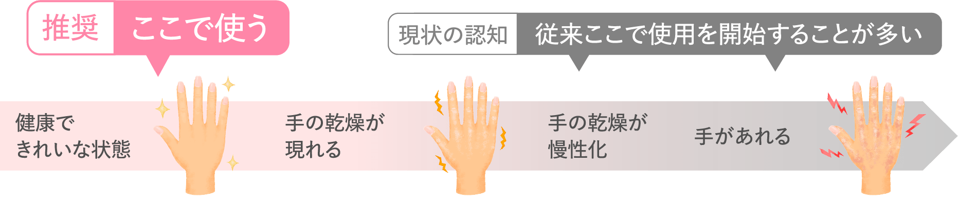 手袋使用開始時期